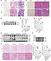 Disruption of FBLN4-mediated copper transfer from ATP7A to LOX suppresses r