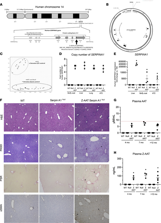 Generation and phenotypic characterization of Z-AAT Serpina1Null murine ...