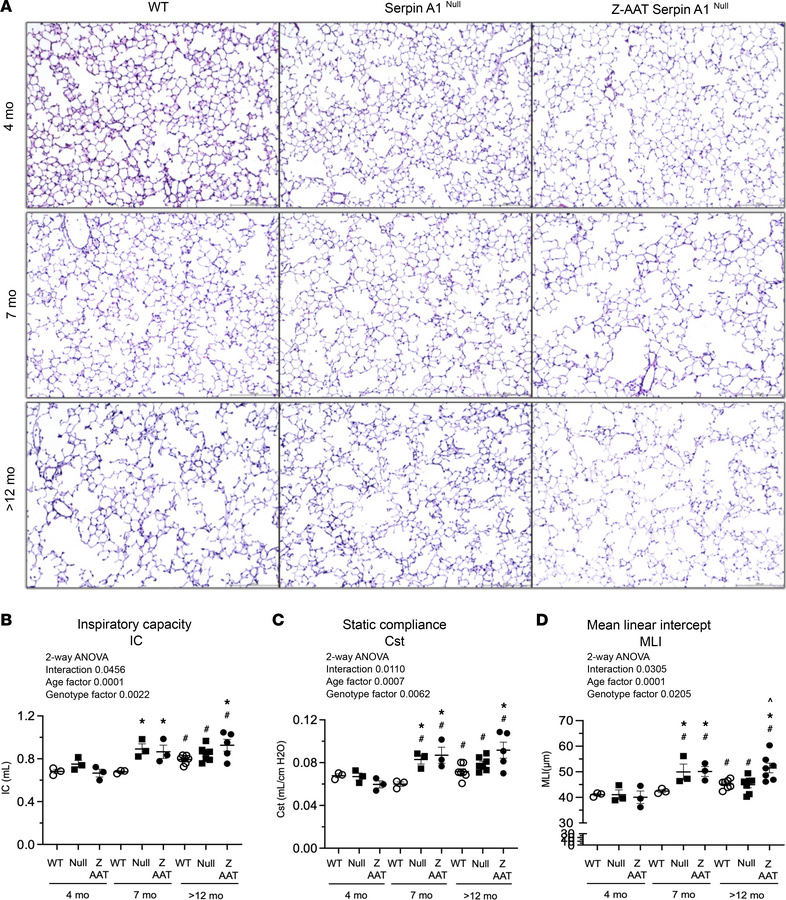 Z-AAT Serpina1Null mice develop spontaneous emphysema-like airspace enla...