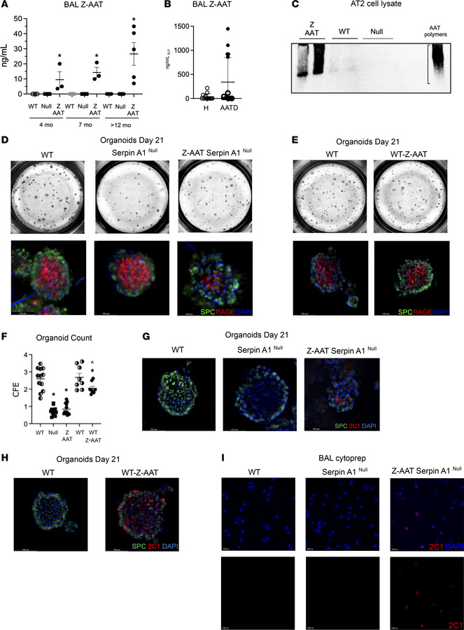 Z-AAT polymers accumulation in lung compartments of Z-AAT Serpina1Null m...