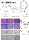 Generation and phenotypic characterization of Z-AAT Serpina1Null murine mod