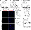 Z-AAT Serpina1Null mice develop lung, systemic inflammation, and protease-a