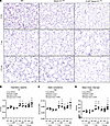 Z-AAT Serpina1Null mice develop spontaneous emphysema-like airspace enlarge