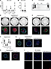 Z-AAT polymers accumulation in lung compartments of Z-AAT Serpina1Null mice