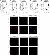 Z-AAT polymers accumulation in alveolar type-2 epithelial cells is associat