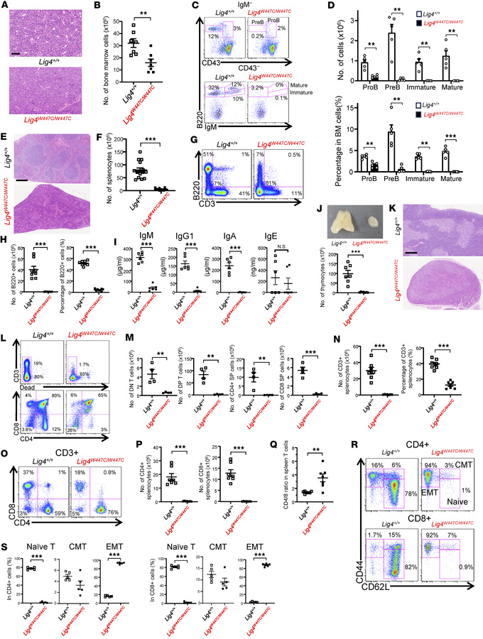 B and T cell differentiation was impaired in Lig4W447C/W447C mice.
(A) H...