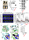 Lig4W447C/W447C mice displayed typical LIG4 syndrome features.