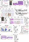 Hematopoietic cells caused severe intestinal inflammation in Lig4W447C/W447