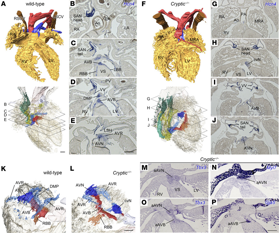 Abnormal cardiac conduction system in the hearts of Cryptic–/– embryos a...