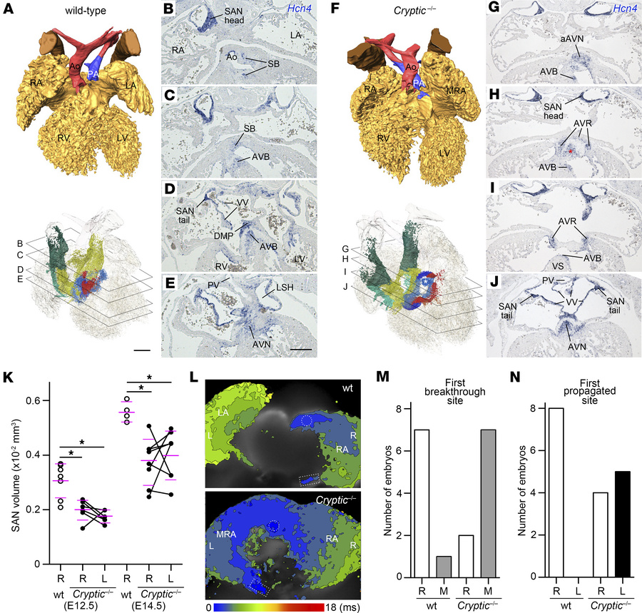 Abnormal cardiac conduction system development in the hearts of Cryptic–...