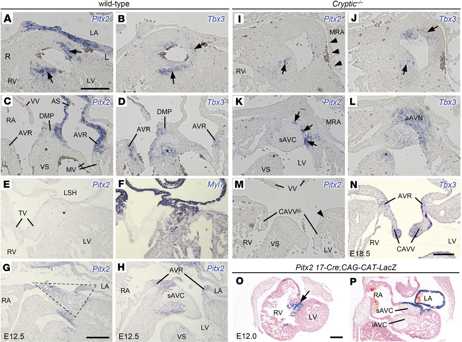 
Pitx2 expression domains in the cardiac conduction system and its cell ...