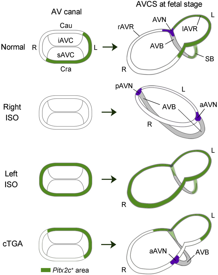 Model for the formation of atrioventricular conduction axis under normal...