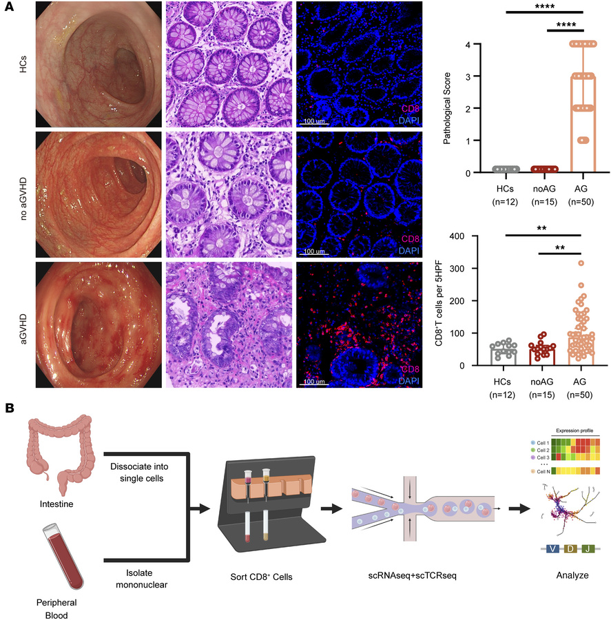 CD8+ T cells are enriched in the intestines of patients with aGVHD.
(A) ...