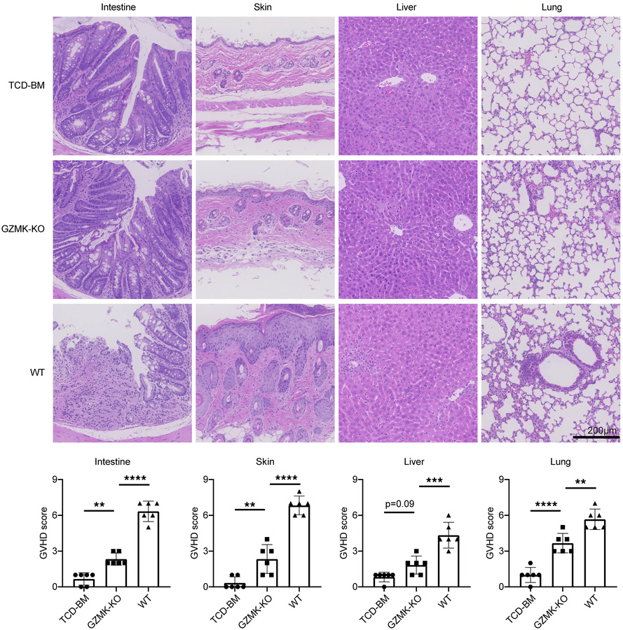 GZMK deficiency alleviates target-organ pathological injury in murine aG...