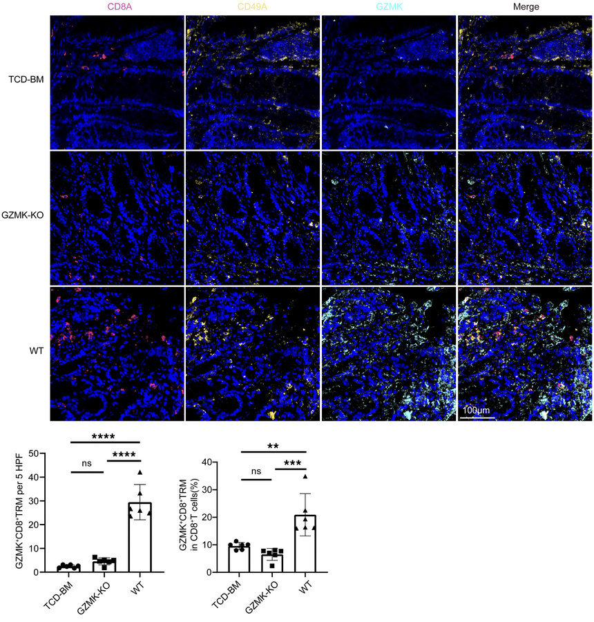 GZMK deficiency reduces intestinal GZMK+CD8+ TRM cell infiltration in mu...
