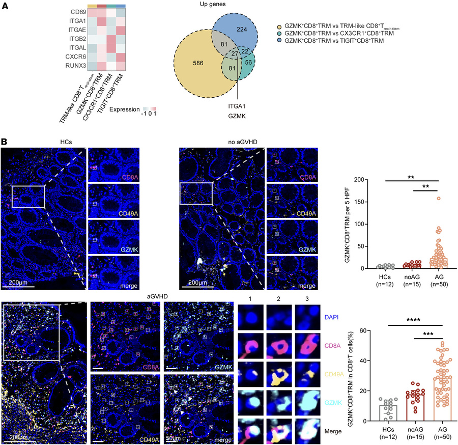 GZMK-expressing CD8+ TRM subset is associated with intestinal aGVHD.
(A)...