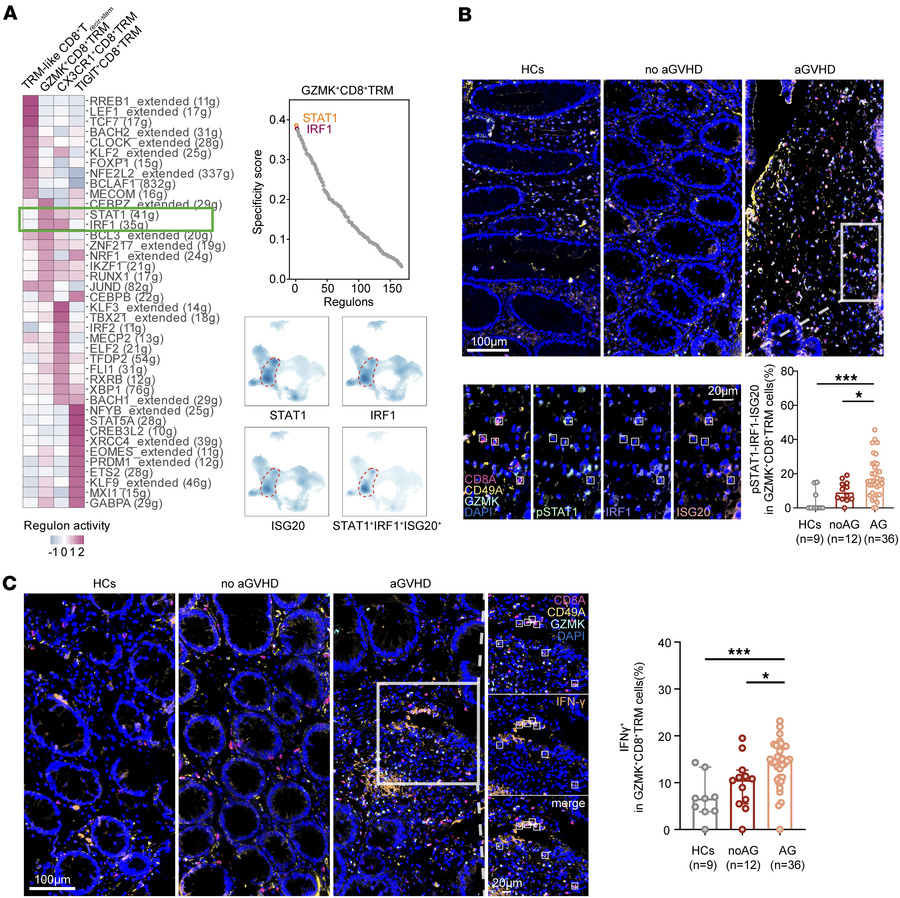 GZMK+CD8+ TRM cells upregulated STAT1/IRF1-related inflammatory signalin...
