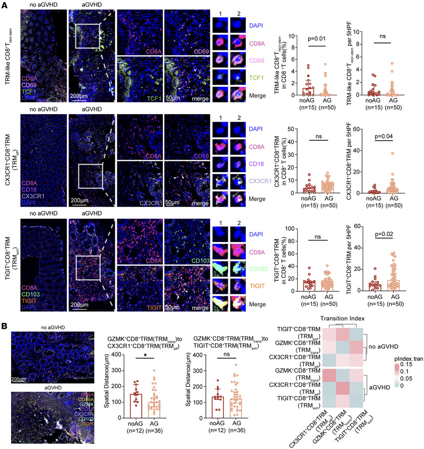 Spatial analysis shows preferential differentiation of GZMK+CD8+ TRM cel...