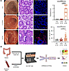 CD8+ T cells are enriched in the intestines of patients with aGVHD.