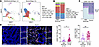 GZMK+CD8+ TRM cell infiltration correlates with intestinal aGVHD severity.