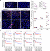GZMK+CD8+ TRM cell infiltration decreases after remission and predicts poor