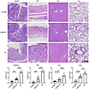GZMK deficiency alleviates target-organ pathological injury in murine aGVHD