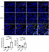 GZMK deficiency reduces intestinal GZMK+CD8+ TRM cell infiltration in murin