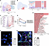 Donor-derived CD8+ TRM cells are enriched in the intestines of aGVHD patien