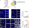 GZMK-expressing CD8+ TRM subset is associated with intestinal aGVHD.