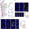 GZMK+CD8+ TRM cells upregulated STAT1/IRF1-related inflammatory signaling i