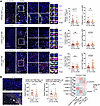 Spatial analysis shows preferential differentiation of GZMK+CD8+ TRM cells