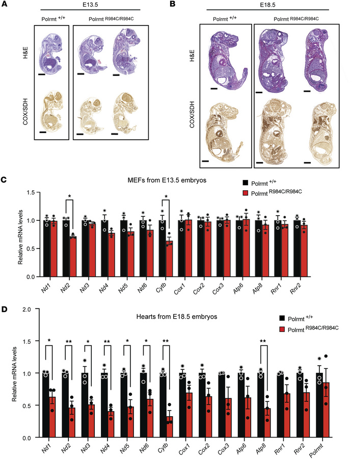 Cryosections and stainings of mouse embryos from the PolrmtR984C line.
(...