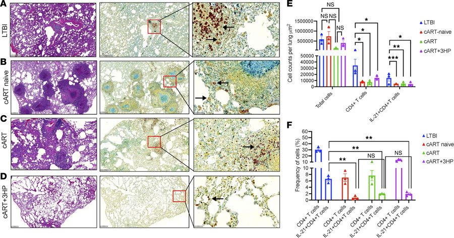 Assessment of IL-21–producing lung CD4+ T cells in M. tuberculosis/SIV c...