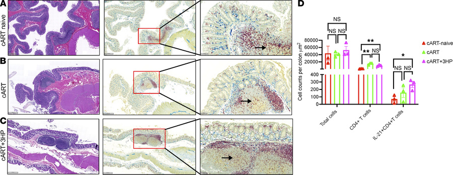 Chromogenic staining and quantification of CD4+ T cells and CD4+IL-21+ T...