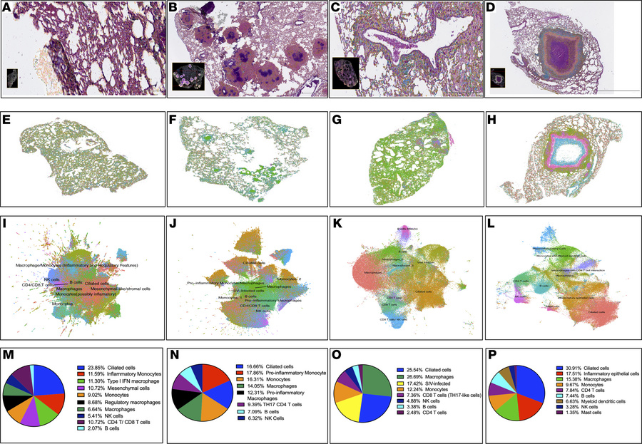 Spatial transcriptomic profiling of lung tissue from RMs across LTBI and...