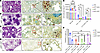 Assessment of IL-21–producing lung CD4+ T cells in M. tuberculosis/SIV coin