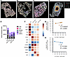 Quantification of Th1 and Th17 response associated transcript counts in lun