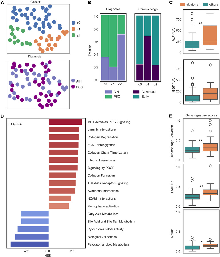 Evaluation of the association between macrophage gene programs and liver...