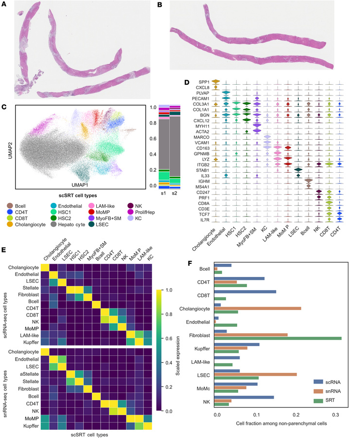 Evaluation of the cell types identified in scSRT PSC samples.
(A and B) ...