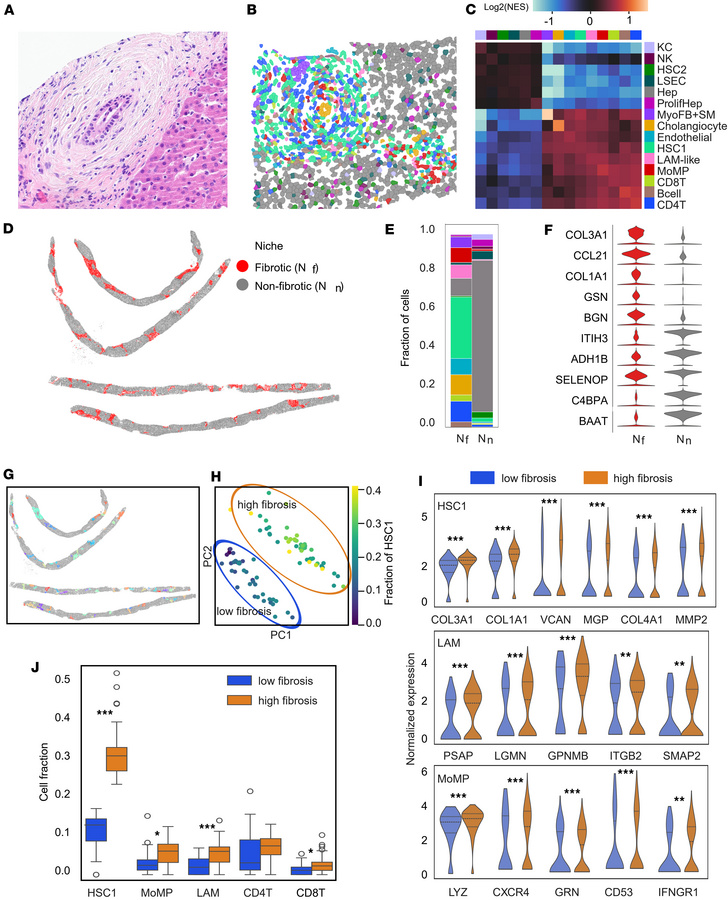 Neighborhood analysis of PSC fibrotic cell niches.
(A) A region with oni...