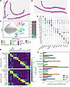Evaluation of the cell types identified in scSRT PSC samples.