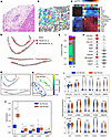 Neighborhood analysis of PSC fibrotic cell niches.