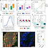 Orthogonal validation of effector and driver fibrotic signatures.