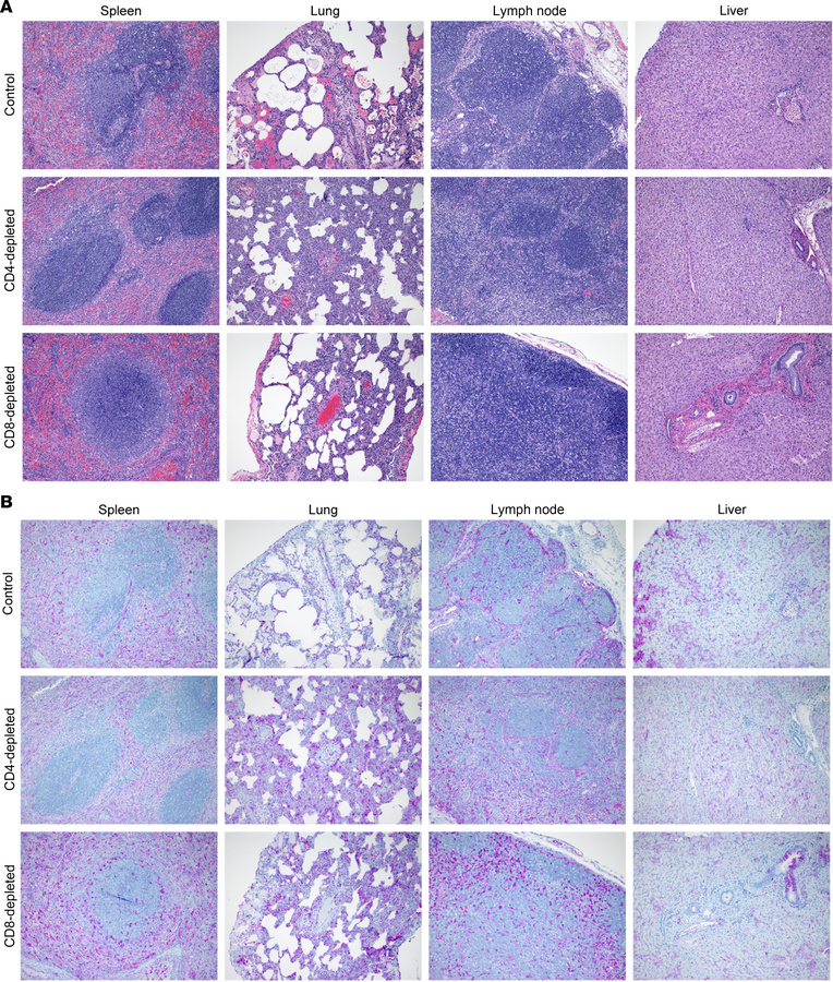 Histopathology of tissues from T cell–depleted LASV-infected cynomolgus ...