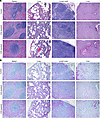 Histopathology of tissues from T cell–depleted LASV-infected cynomolgus mac