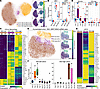 Distinct ISG states associated with primary and booster mRNA vaccination in