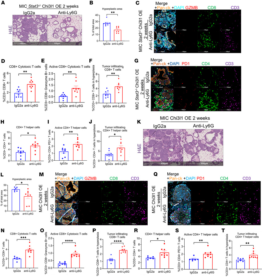 Neutrophil depletion abrogates the effects of Chi3l1 OE.
(A) H&amp;E sta...