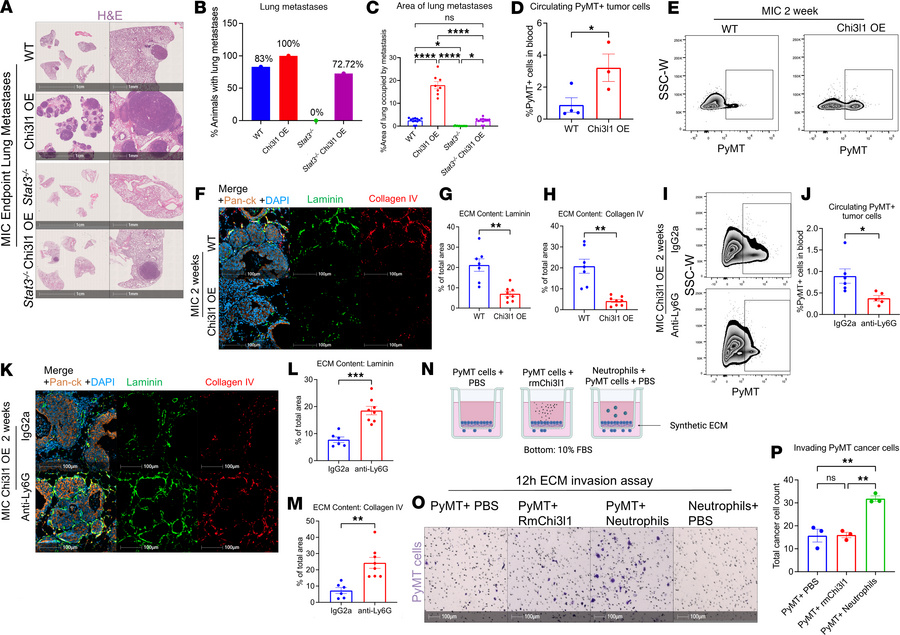 Chi3l1 OE enhances metastatic dissemination through neutrophil-mediated ...