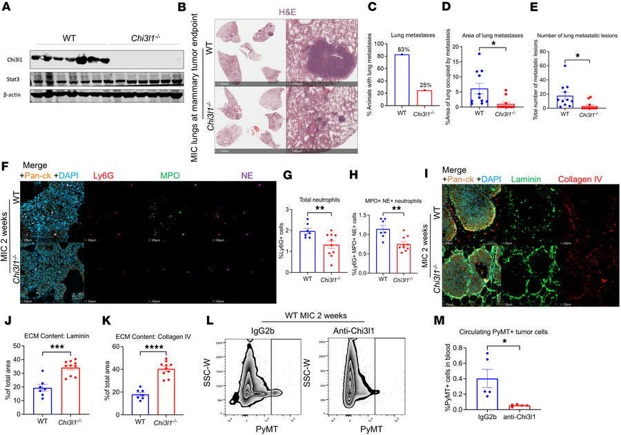 Chi3l1 ablation inhibits breast cancer metastasis.
(A) Immunoblots for C...