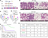 Chi3l1 OE rescues mammary tumor onset in Stat3-deficient MIC mice.